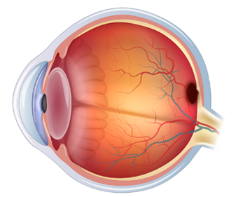 Agujero Macular